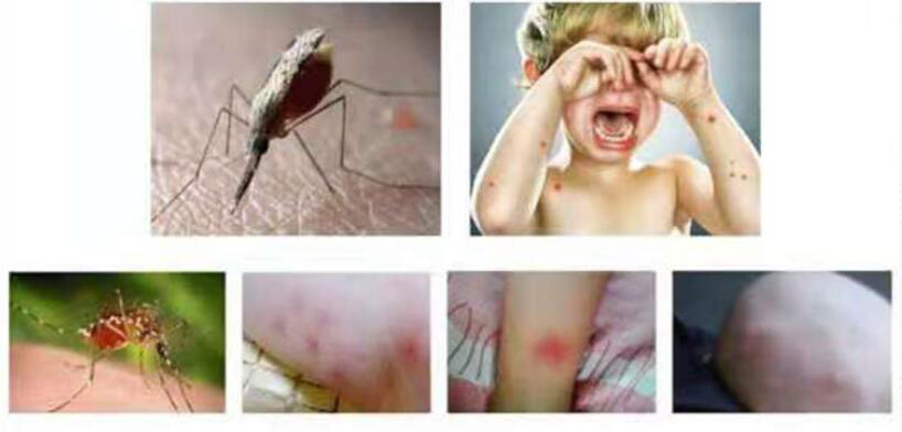 Anti Mosquito Repellent Wristband